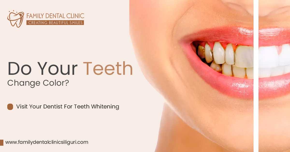 Do Your Teeth Change Color? Visit Your Dentist For Teeth Whitening