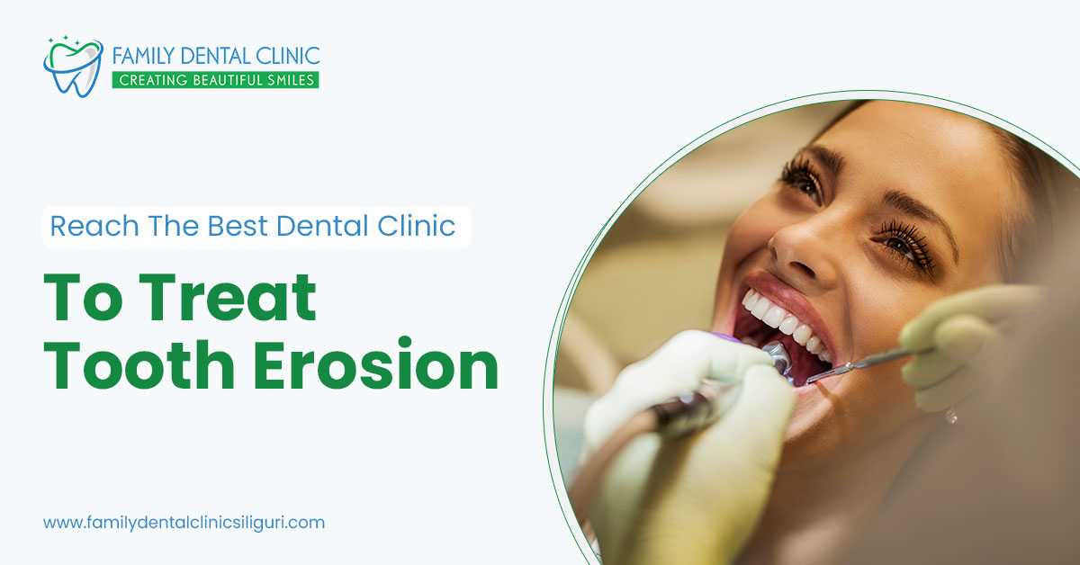 Consult The Best Dental Clinic For Tooth Erosion