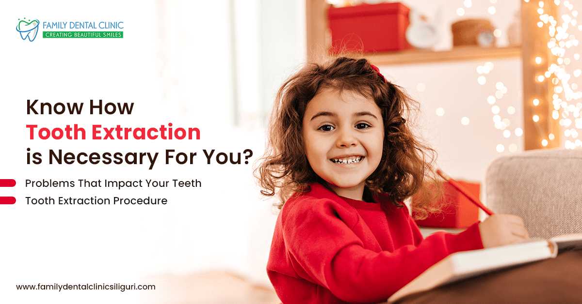 Does Tooth Extraction Is Necessary For You? Know From Your Dentist Today