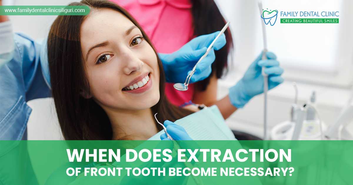 When Does Extraction Of Front Tooth Become Necessary?