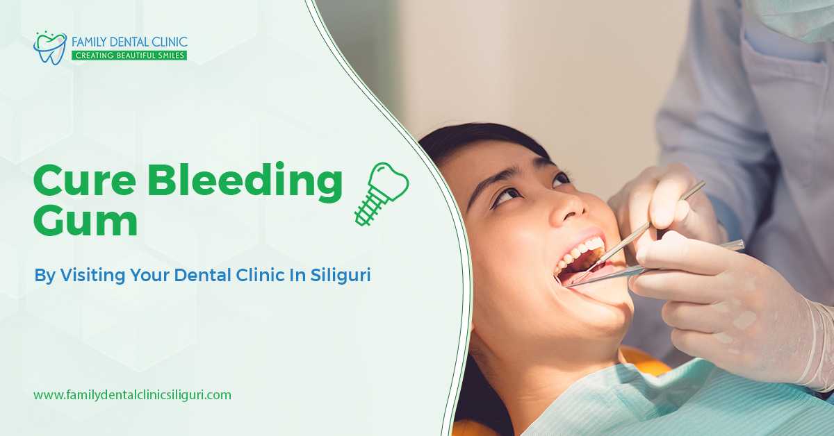 Cure Bleeding Gum By Visiting Your Dental Clinic In Siliguri