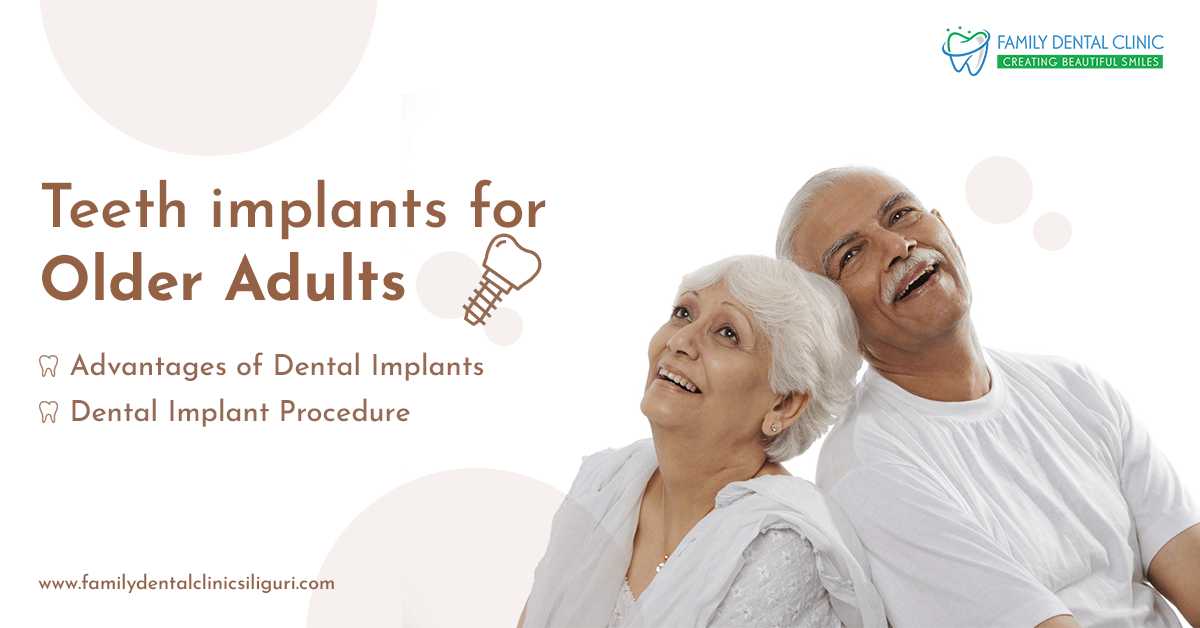 Teeth Implants For Older Adults
